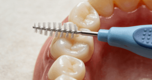 escova interdental macia