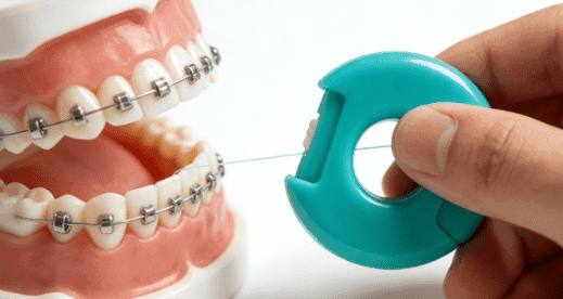 diferentes tipos de hilo dental